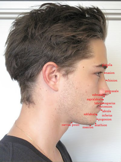 Soft tissue lateral cephalometric landmarks lachowski.png