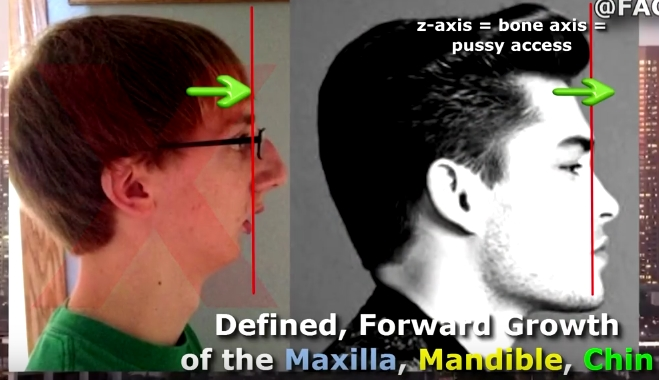 File:Chin maxilla.png